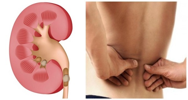 Healthy Urine – KIDNEY SUPPORT – Bladder Health – Kidney Boost – 1 Bottle