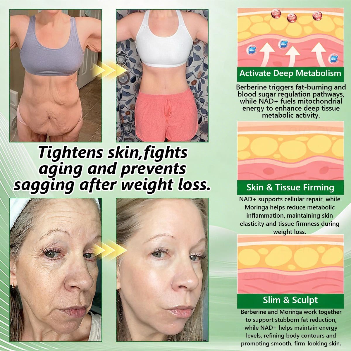 CareUplift Berberine X NAD+ 10-in-1 Nano Microneedle Patches for Weight