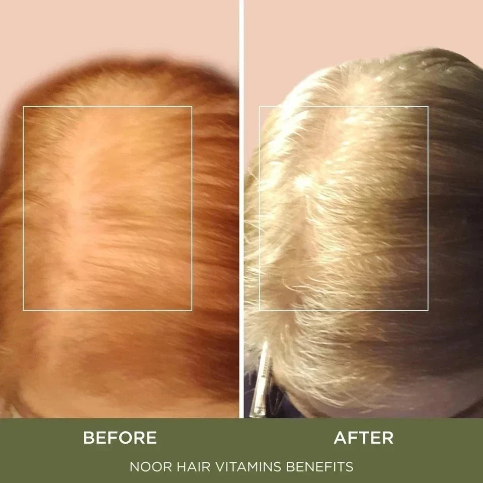 3-Pack NOOR Wellness Hair Formula – NOOR Hair Growth Supports Capsule
