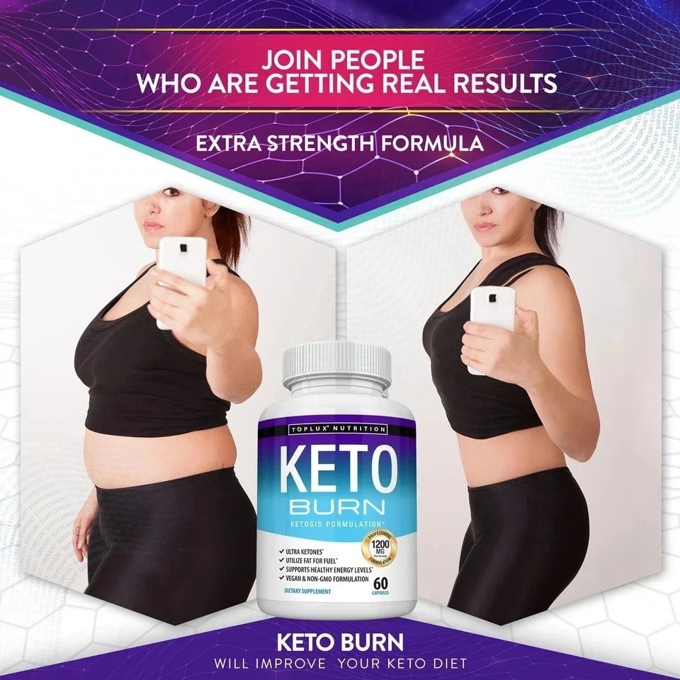 HOT-Toplux Keto Burn Pills Ketosis Weight Loss – 1200 Mg Ultra Advanced Natural